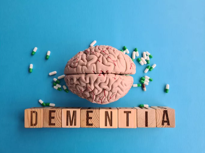 Dementia: The Best Way to Understand It