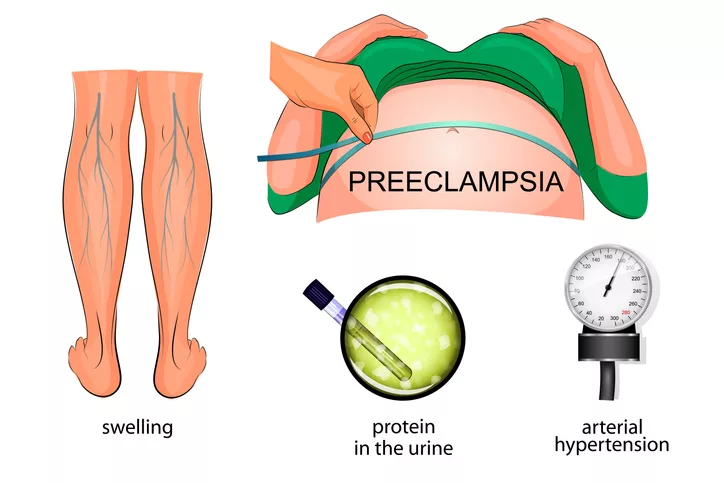 Hypertension 