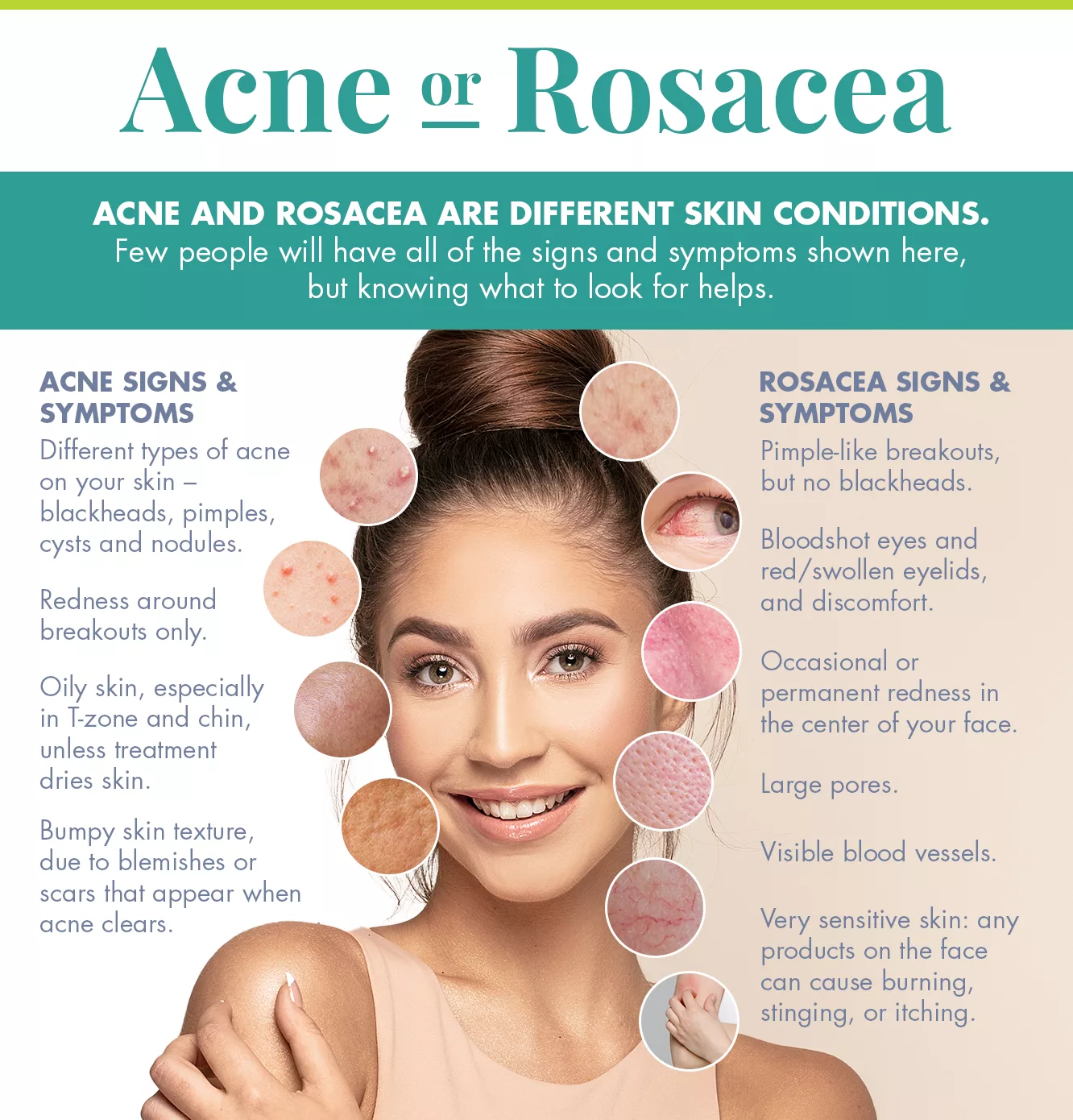 All About Rosacea Treatment: From Causes to Treatment
