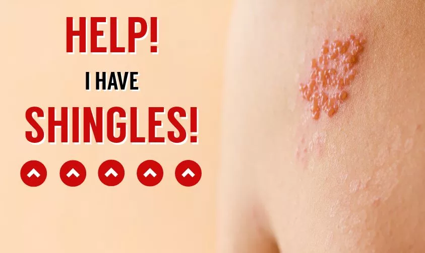 Shingles: Causes, Symptoms, and Treatment Methods