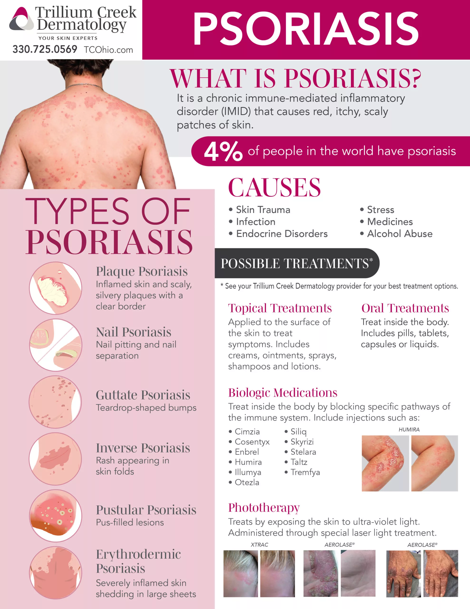 Psoriasis: Everything You Want to Know – Understanding, Prevention, and Treatment