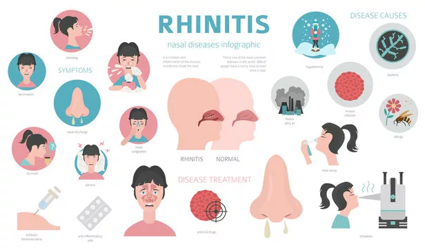 Solving the Discomfort Brought by Rhinitis: Known Treatments and Prevention Methods