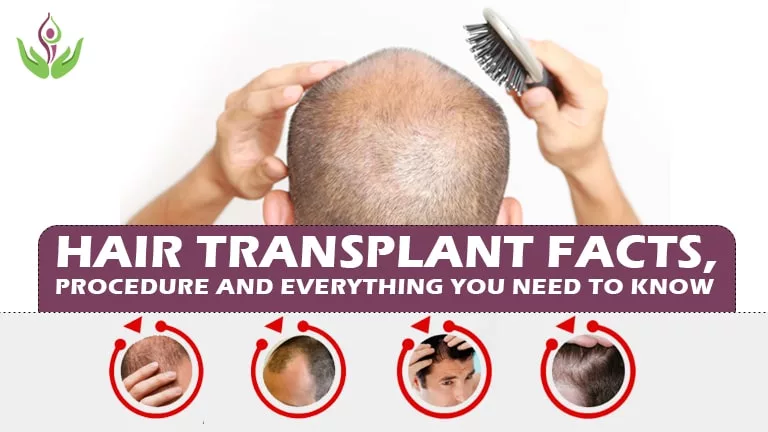 Regaining Lost Confidence: Understanding the Entire Process of Hair Transplantation