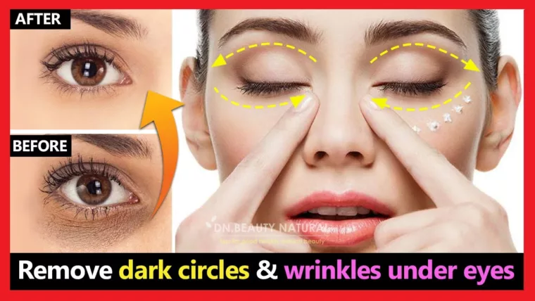 Dark Circles