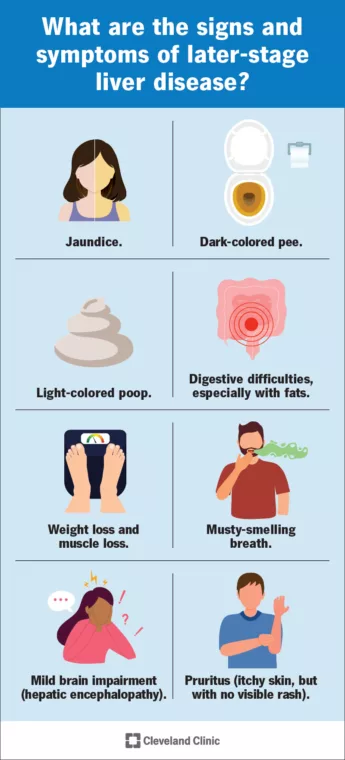 Cirrhosis