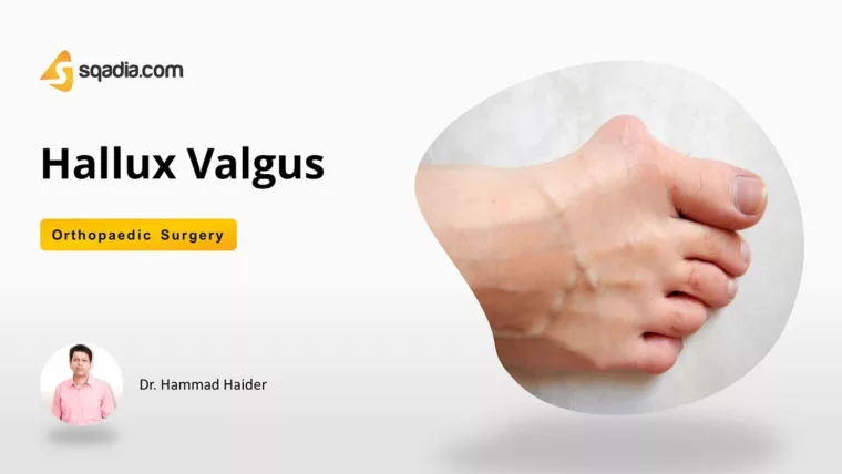 Hallux Valgus