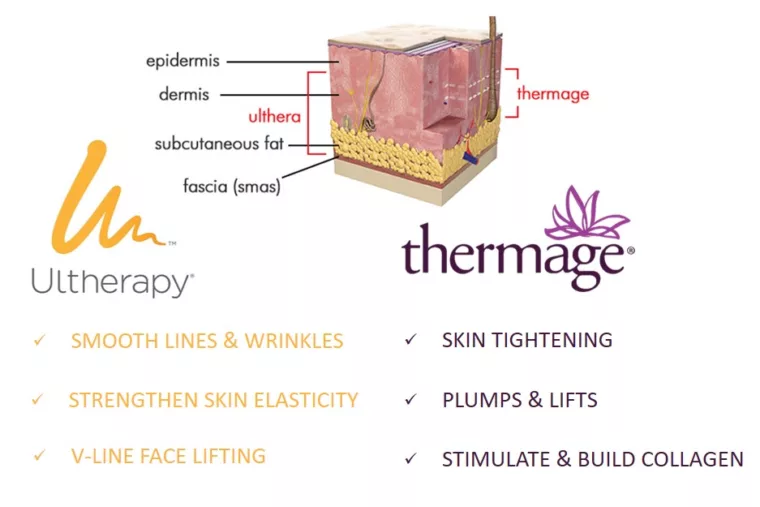 Ultherapy vs. Thermage