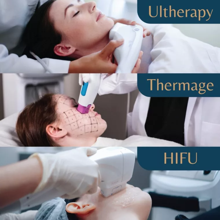 Ultherapy vs. Thermage