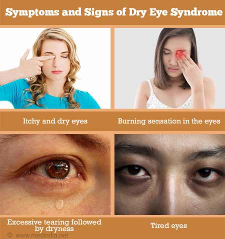 Dry Eye Syndrome