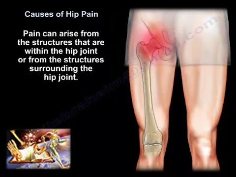 Hip Pain