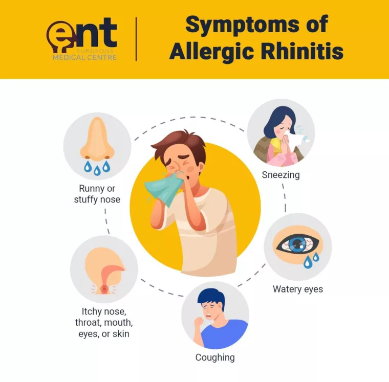 Allergic Rhinitis