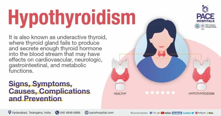 Thyroid Nodules