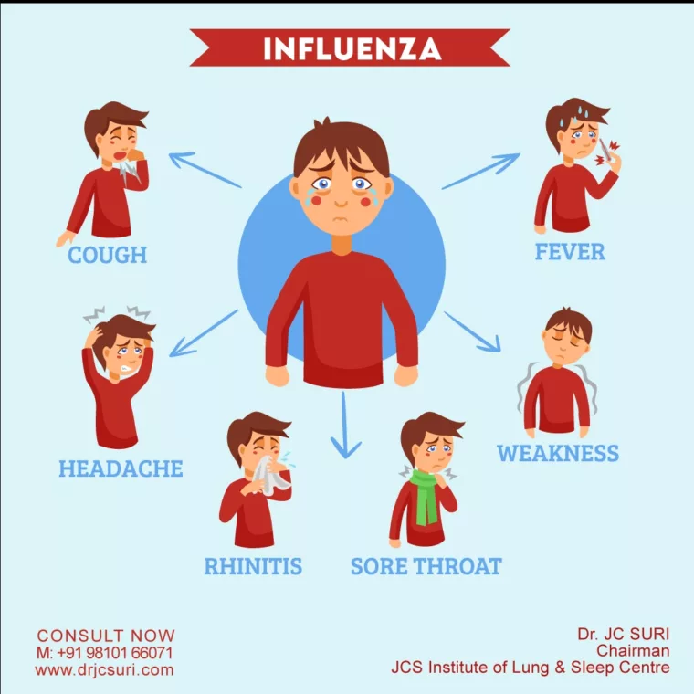  Influenza