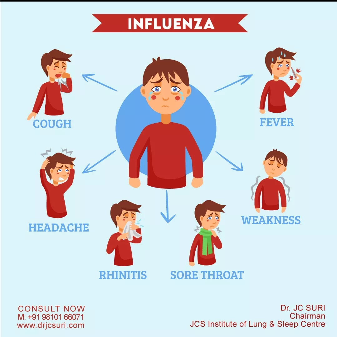 Symptoms and Treatments of Influenza