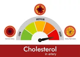 Cholesterol