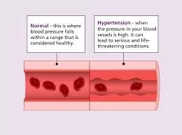 Cholesterol